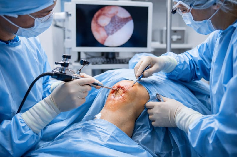 ricostruzione cartilagine ginocchio